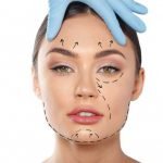 بوتاکس یا هایفوتراپی؟ کدام بهتر است؟