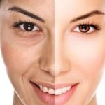 هیدرودرمی چیست؟