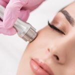 میکرودرم ابریژن چیست؟