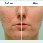 سابسیژن پوست چیست و چه کاربردی دارد؟